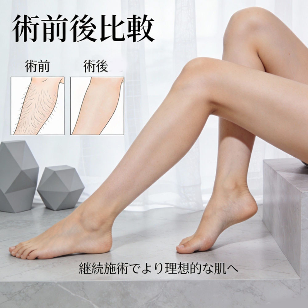 拒绝尴尬的脱毛术