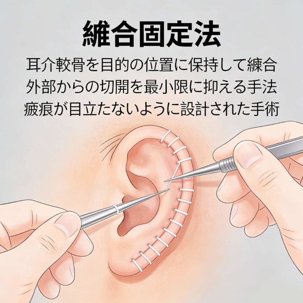 悄然变美的精致耳型