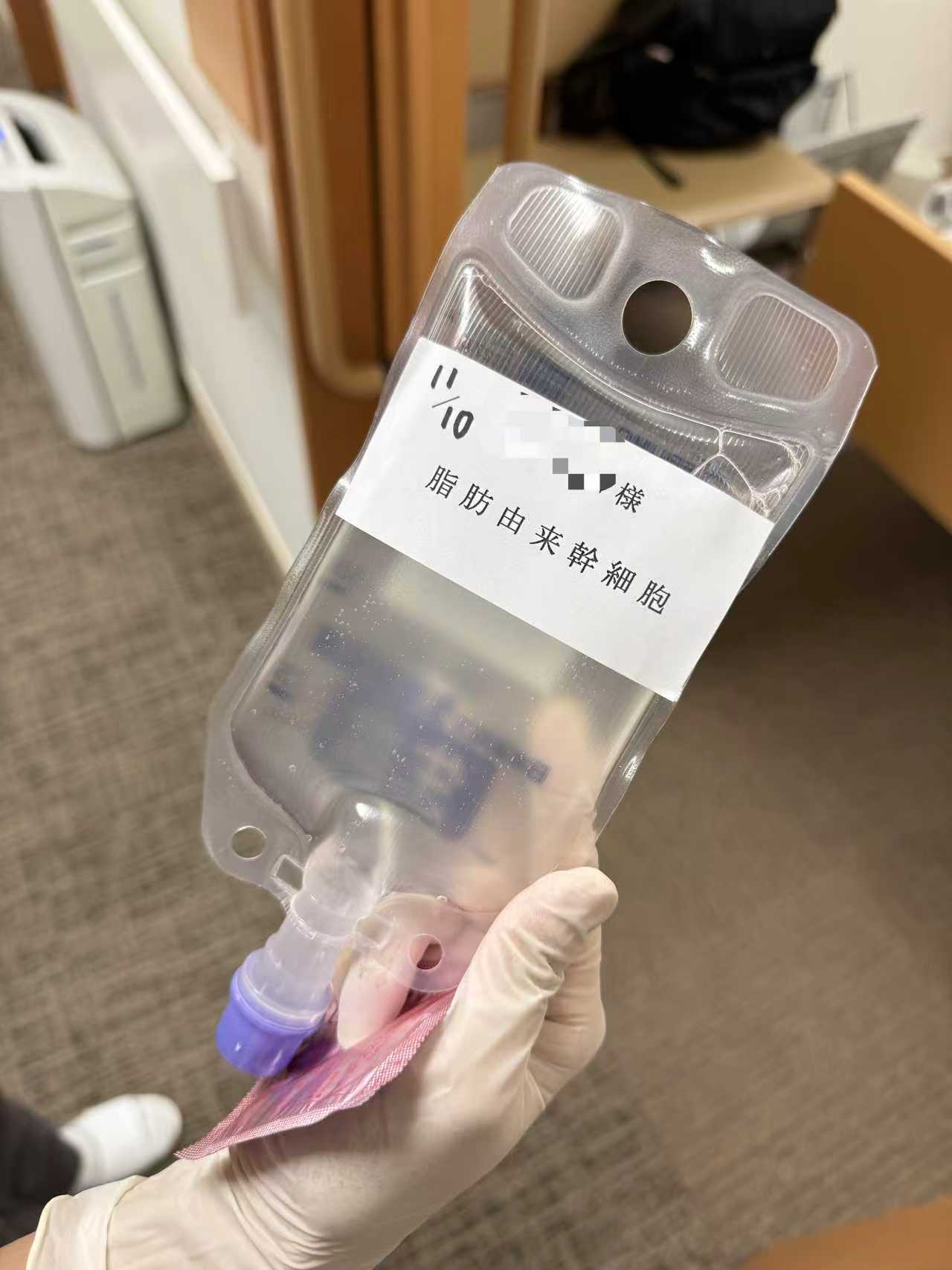 抗衰老干细胞注射